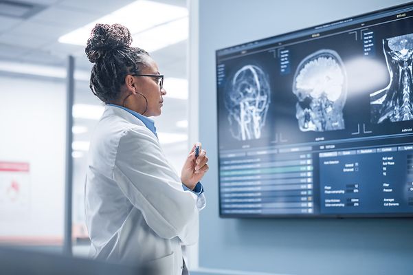Doctor examining brain scans on a monitor.